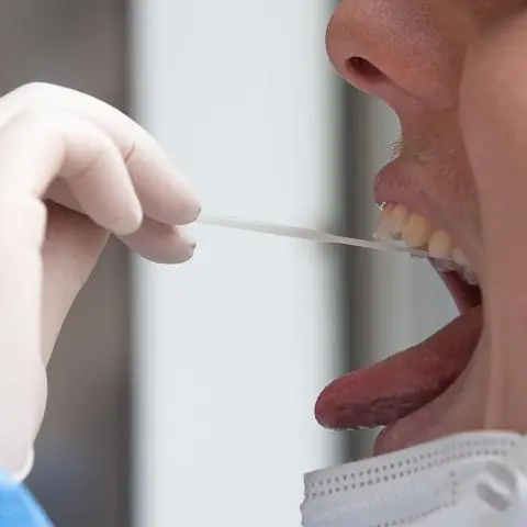 Insgesamt weitere positive Corona-Testergebnisse hat das Odenwälder Gesundheitsamt am Dienstag registriert.