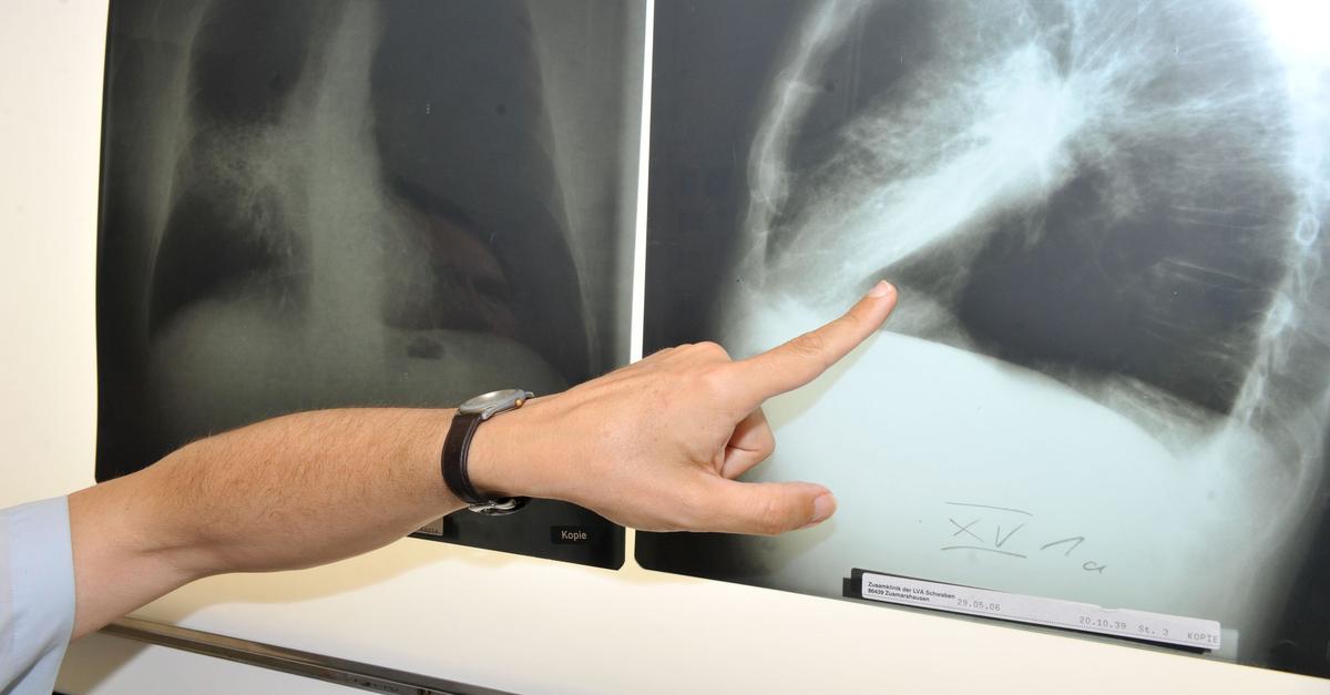 Cancer therapy: Mainz-based BioNTech makes up for recent mRNA setback
